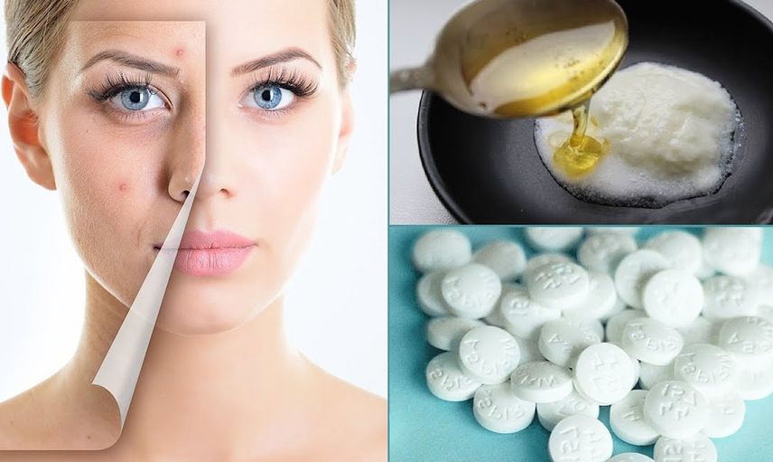 Aspirinin Cilde Faydaları Nelerdir?