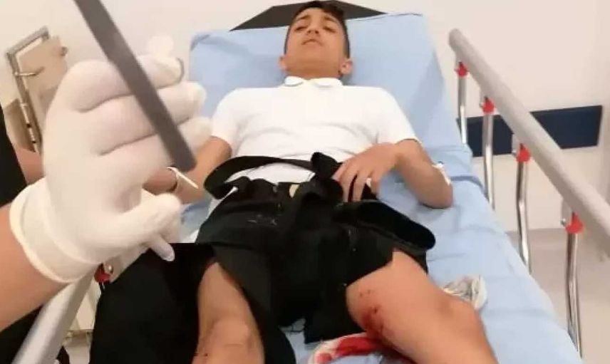 Başıboş köpek saldırısı devam ediyor: Okula giderken köpeklerin saldırısına uğradı