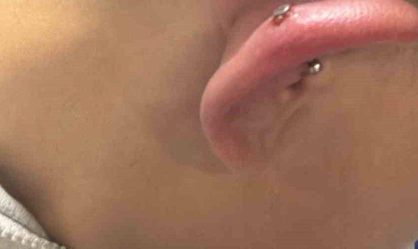 Bursa'da kulağında piercing kabusu yaşayan genç hastaneye kaldırıldı