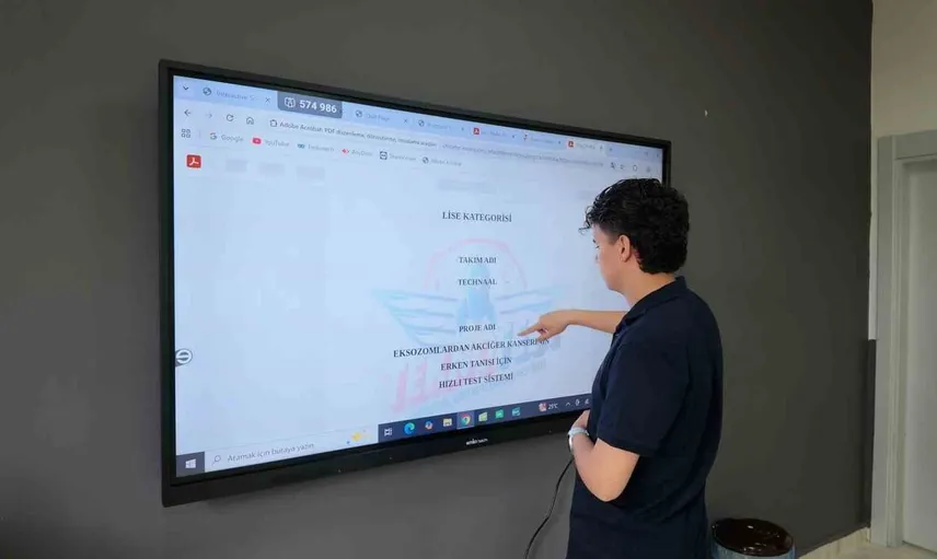 Niğdeli öğrenci akciğer kanseri için yenilikçi biyosensör geliştirdi
