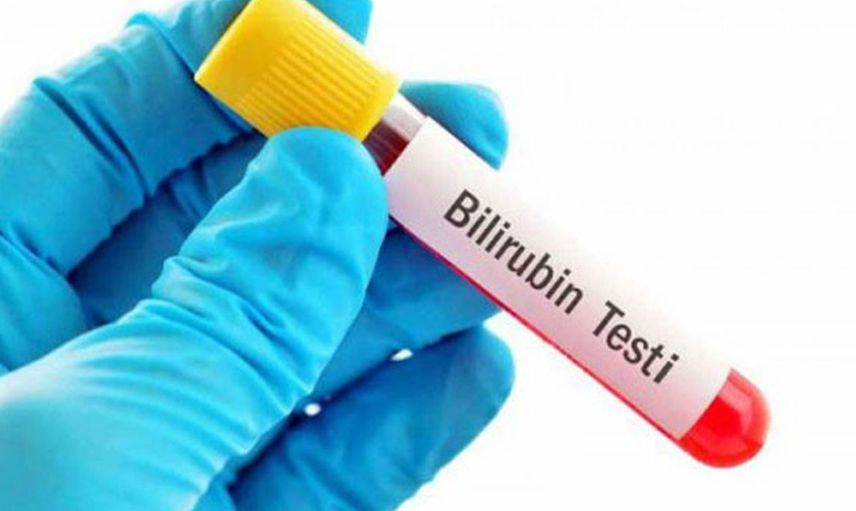Bilirubin Nedir, Bilirubin Yüksekliği Ve Düşüklüğünün Sebepleri Nelerdir?