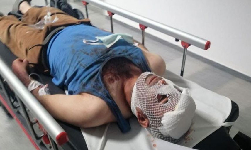 Bir Grup Maganda 15 Yaşındaki Kızı Kaçırmak İçin Evi Bastılar: 3 Yaralı