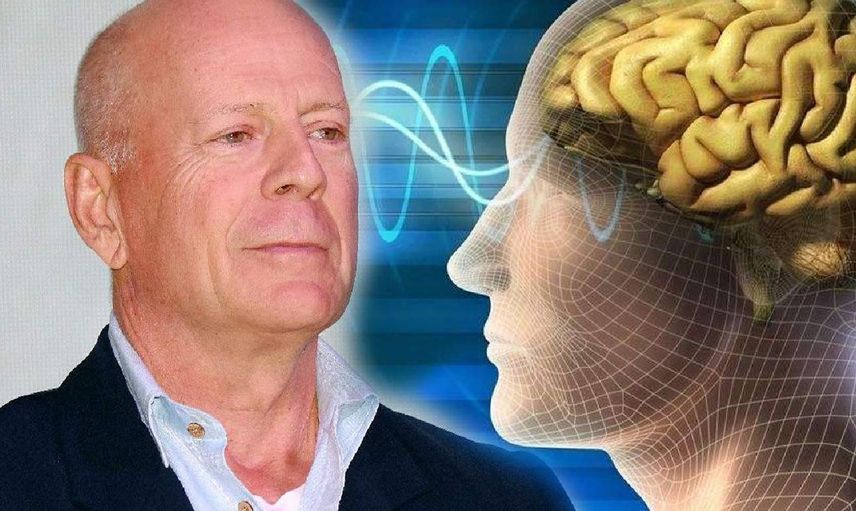 Bruce Willis'in hastalığı afazi nedir? Afazi hastalığı nedir, belirtileri nelerdir?