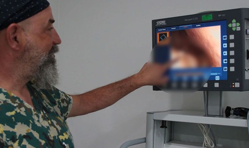 Burun tıkanıklığı ve hapşırık şikayetiyle doktora gitti: Öğrendiği gerçek karşısında neye uğradığını şaşırdı