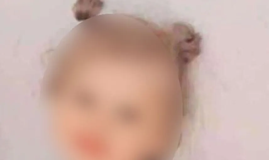 Kedi ısırığı sonrası kuduz tanısı konan çocuk hayatını kaybetti