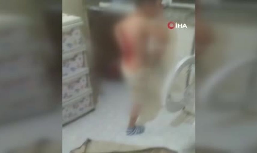 Akran zorbalığı iddialarıyla gündemde: 12 yaşındaki çocuğun sırtı kolonya ile yandı