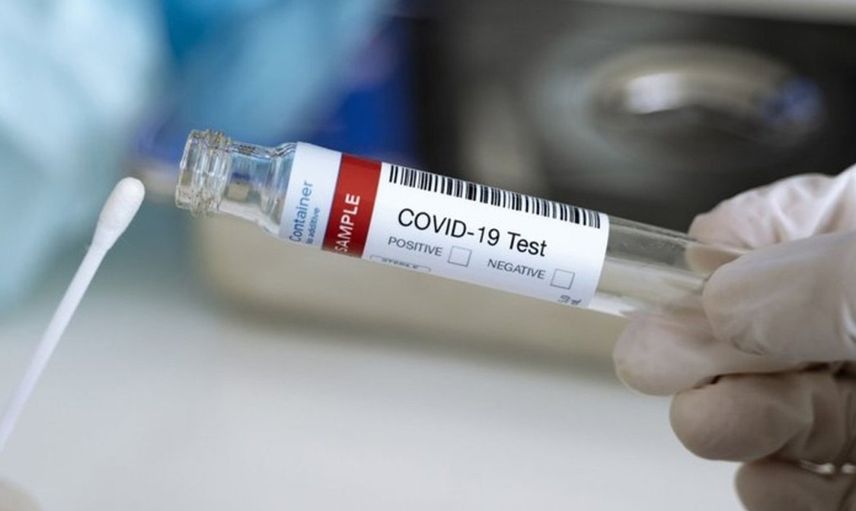 Çinli Araştırmacılardan Yeni Buluş: Koronavirüs Testi 4 Dakikada Sonuçlanıyor!