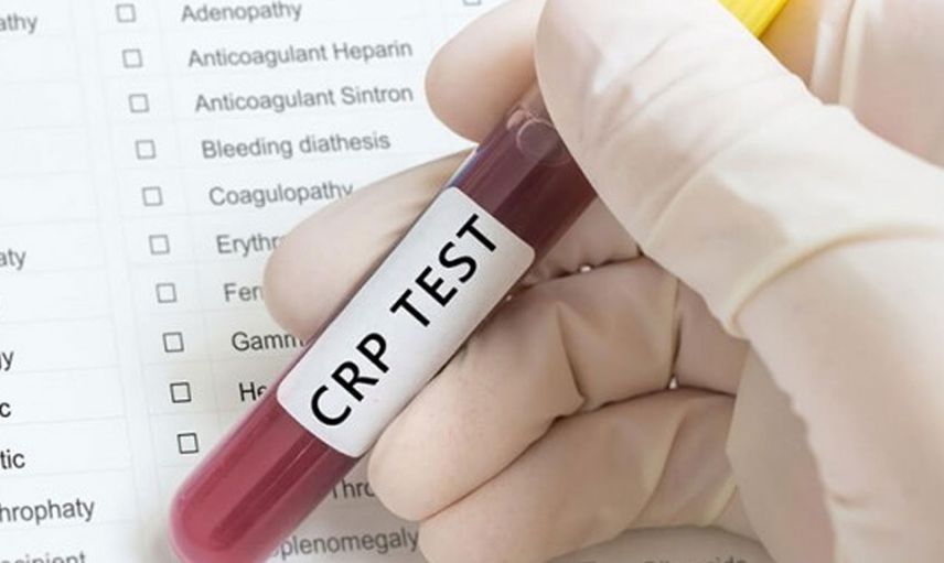 CRP yüksekliği nedir?