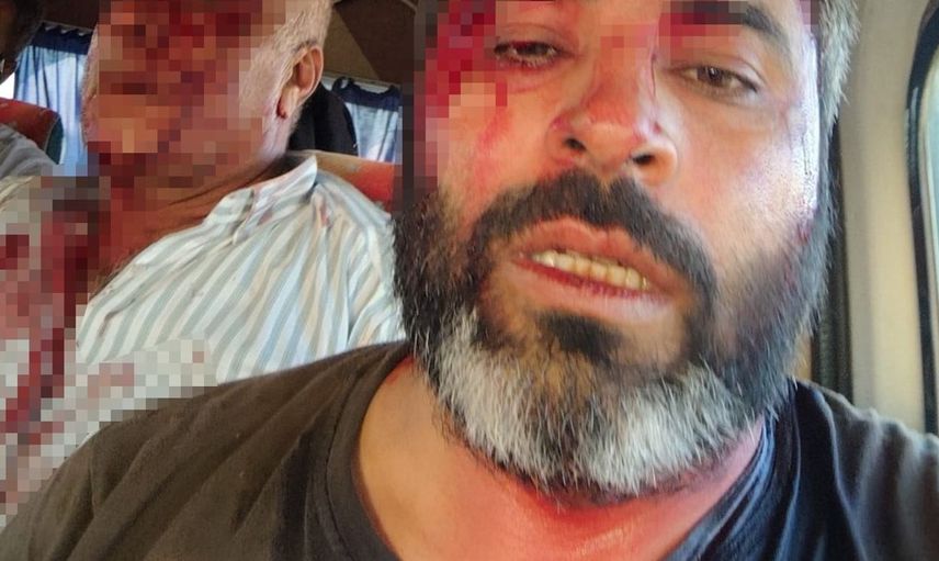 Akçakale'de arazi anlaşmazlığı nedeniyle kavga: 8 yaralı