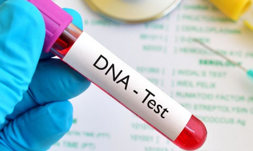 Dna Testi Nasıl Yapılır?