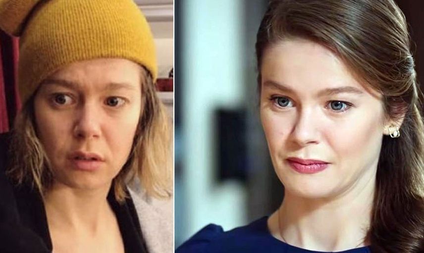 Doğal Olduğunu Savunan Burcu Biricik'in Eski Hali Ortaya Çıktı!