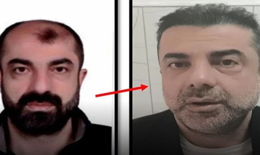 Estetikle Yüzünü Değiştirip Kaçan Firari Zanlı Yakalandı