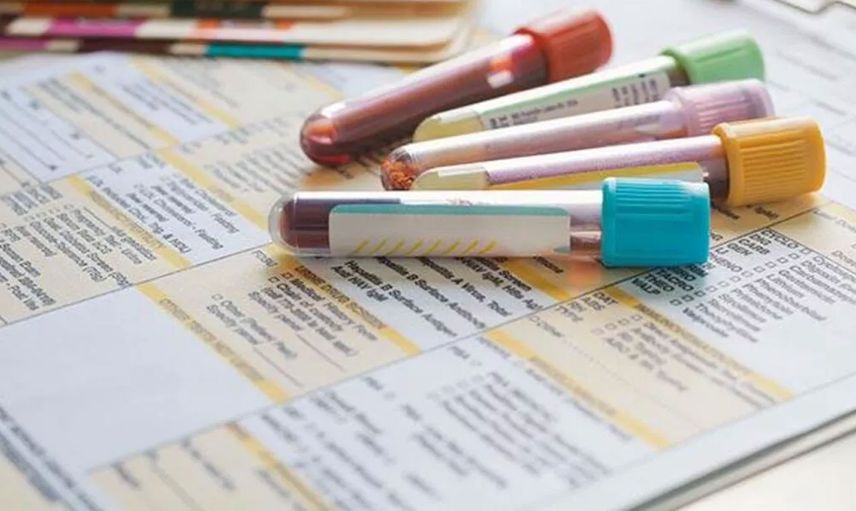 Ferritin nedir, ne demek? Ferritin testi nasıl yapılır? Ferritin normal değerleri