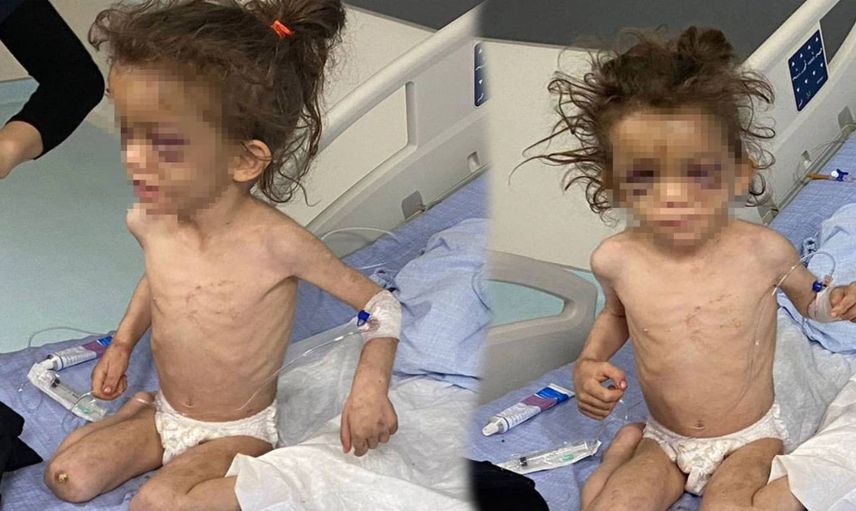 Gaziantep vahşetinde yeni gelişme: Devlet çocuğu koruma altına aldı