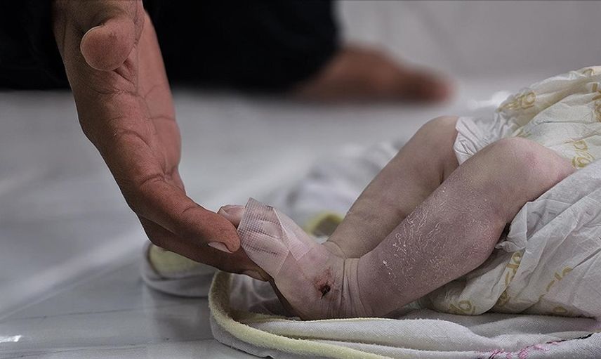 Gazze’de Soğuk Bir Can Daha Aldı: 3 Aylık Tim Çadırda Donarak Öldü