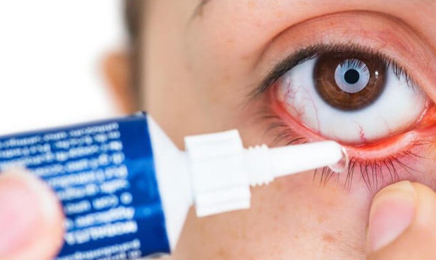 Göz Nezlesi (Konjuktivit) Nedir?