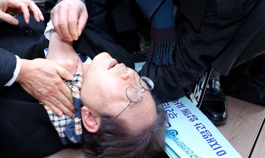 Güney Kore'de skandal olay: Parti lideri boynundan bıçaklandı