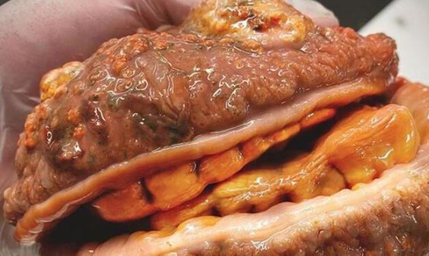 Hamburger Sandılar Balık Çıktı! Sosyal Medya Bu Görüntüleri Konuşuyor
