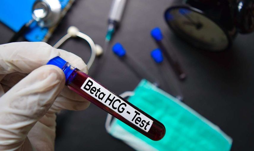 Hamilelik döneminde Beta HCG değerleri kaç olmalıdır? Beta HCG gebelik hesaplama tablosu 2022