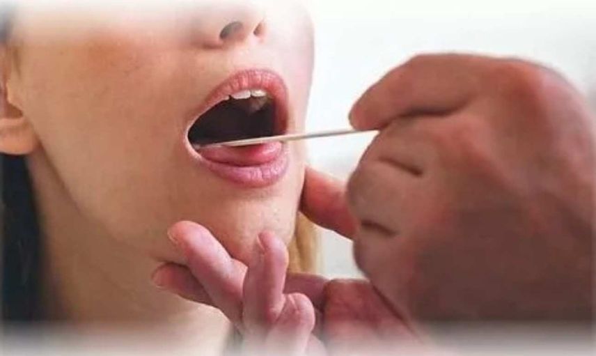 Harita dil hastalığı nedir, nasıl tedavi edilir? Harita dil hastalığında tedavi yöntemleri