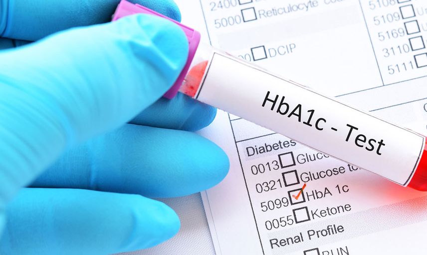 HbA1c nedir, normal değeri kaç olmalı, tedavisi nasıl yapılır?  Şeker hastalarının kabusu HbA1c yüksekliği hakkında bilmeniz gerekenler 