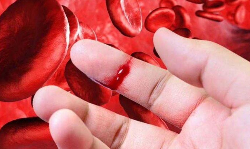 Hemofili hastalığı tedavi yönteminde dikkat edilmesi gereken yöntemler!