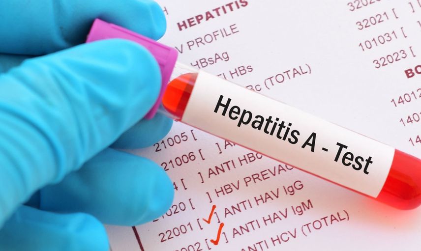 Hepatit A Neden Olur, Nasıl Geçer?