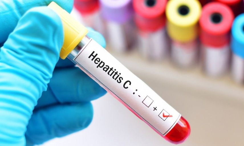 Hepatit C nedir, nasıl bulaşır, aşısı var mı? Hepatit C'den korunma yolları