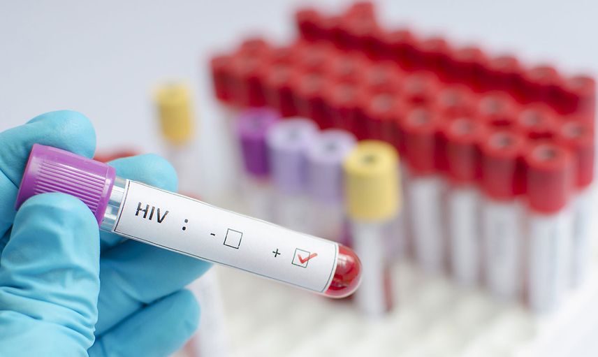 HIV nedir, belirtileri nelerdir, nasıl bulaşır, ölümcül müdür? HIV'in tespit edilen 3 bulaşma yolu