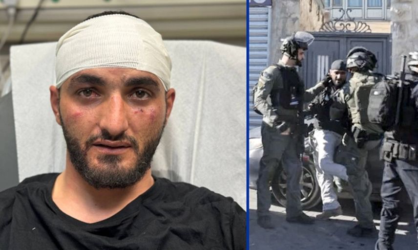 İşgalci İsrail polisleri Türk gazeteciye saldırdı: Tekmeleyerek darp ettiler