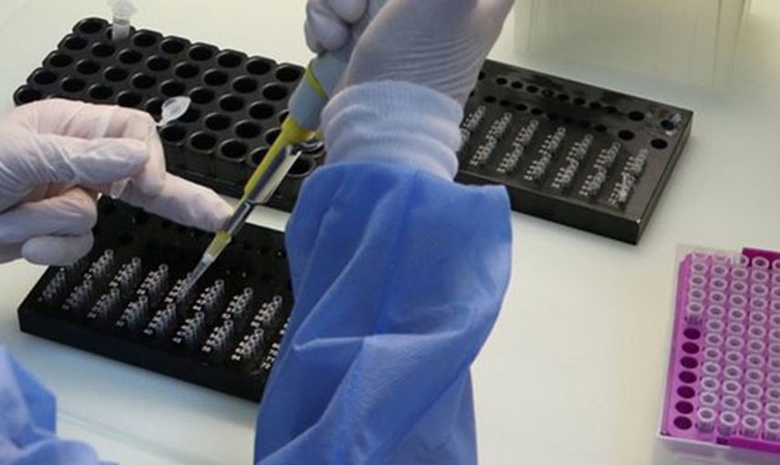Japon Araştırmacılar Kovid-19'u 5 Dakikada Saptayabilen Test Yöntemini Buldu
