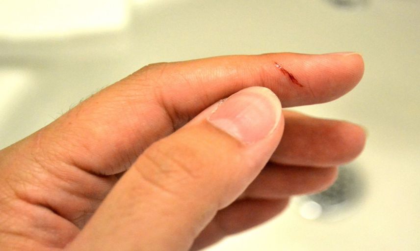 Kağıt kesiğinin dayanılmaz acısının sırrı ortaya çıktı: Meğer bu yüzden canımızı çok yakıyor