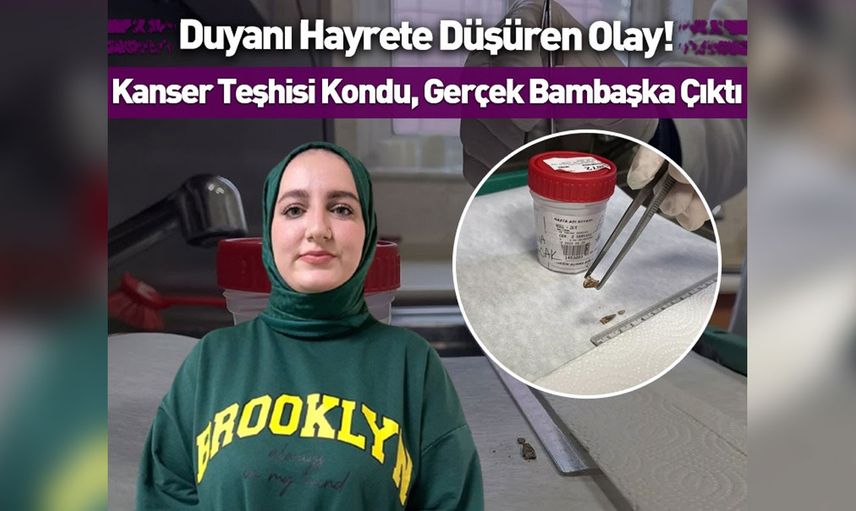 Kanser teşhisi kondu, badem zarı çıktı! Duyanı hayrete düşüren olay
