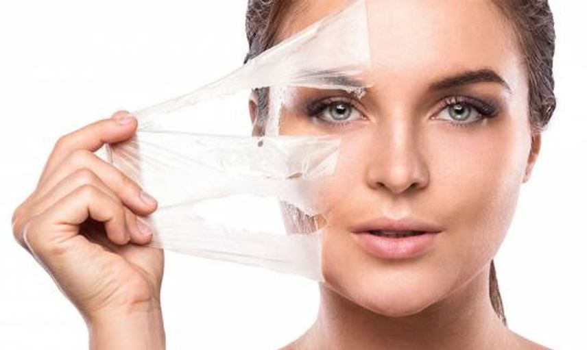Kimyasal Peeling Ne İşe Yarar?