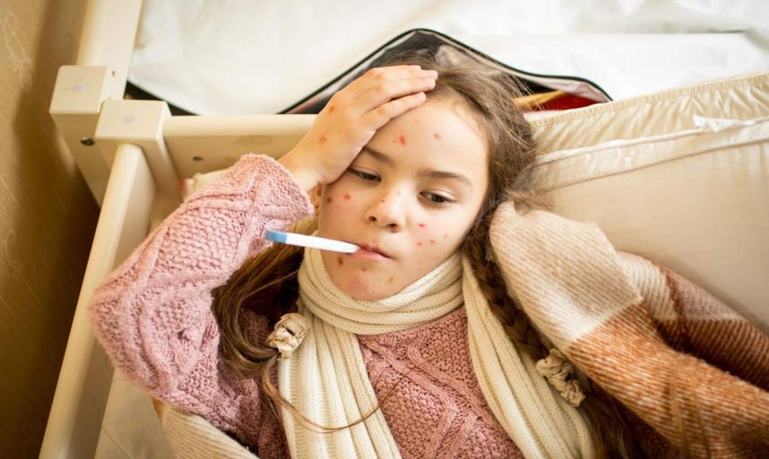Kızamık vakaları yeniden arttı: 2 çocuk hayatını kaybetti
