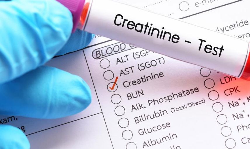 Kreatinin Nedir?