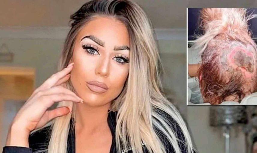 Kuaförde saçını boyattı, derisini kaybetti!