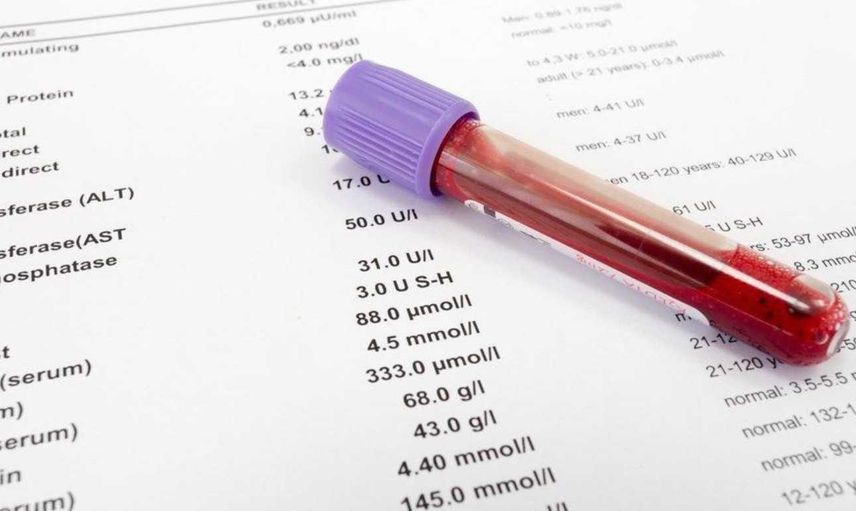 Lipaz enzimi normal değeri kaç olmalı? Lipaz değeri yüksekliği ve düşüklüğü tedavileri