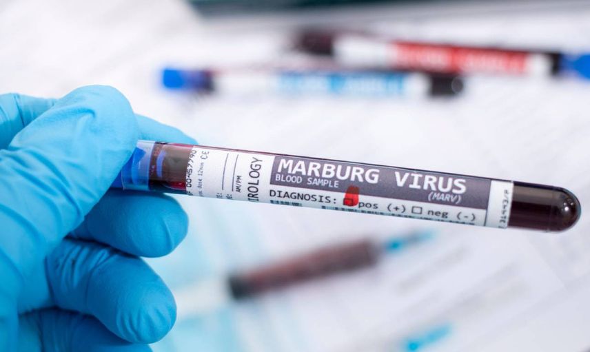 Marburg virüsü nedir, ölümcül mü? Marburg virüsü belirtileri neler, tedavisi var mı? Dünyanın en ölümcül virüsü yeniden ortaya çıktı