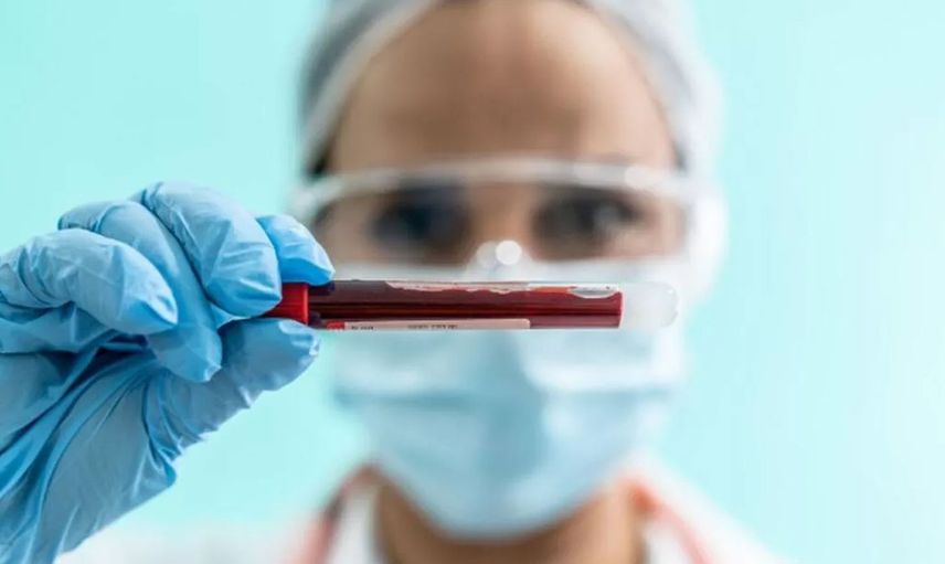 MCHC kan tahlili nedir, neden istenir? MCHC hangi durumlarda artar? MCHC yüksekliği ve düşüklüğünün etkileri