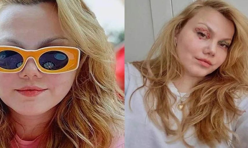 Merve Veziroğlu kimdir, nereli ve kaç yaşında? Youtuber Merve Veziroğlu neden gündemde, sağlık durumu nasıl?