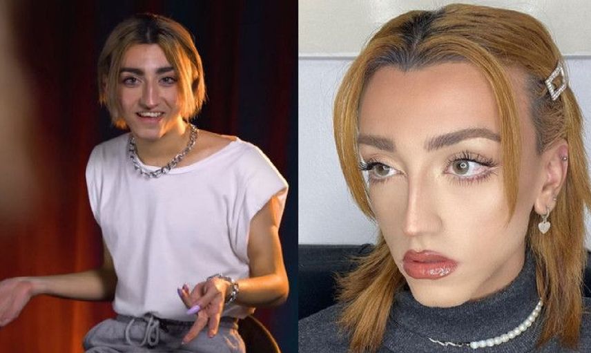 Mika Can Raun aslen nereli? Mika Türk mü? Mika Raun estetik olmadan önceki hali? Estetik oldu mu?