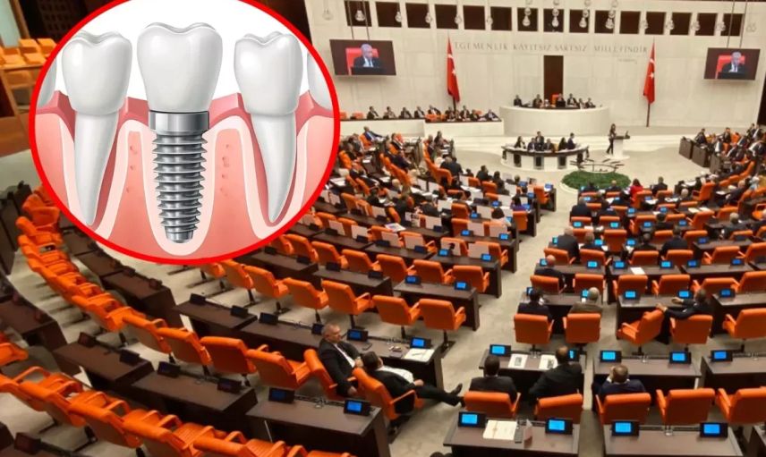 Milyonları ilgilendiren düzenleme Meclis’te: İmplant tedavileri SGK kapsamına alınıyor