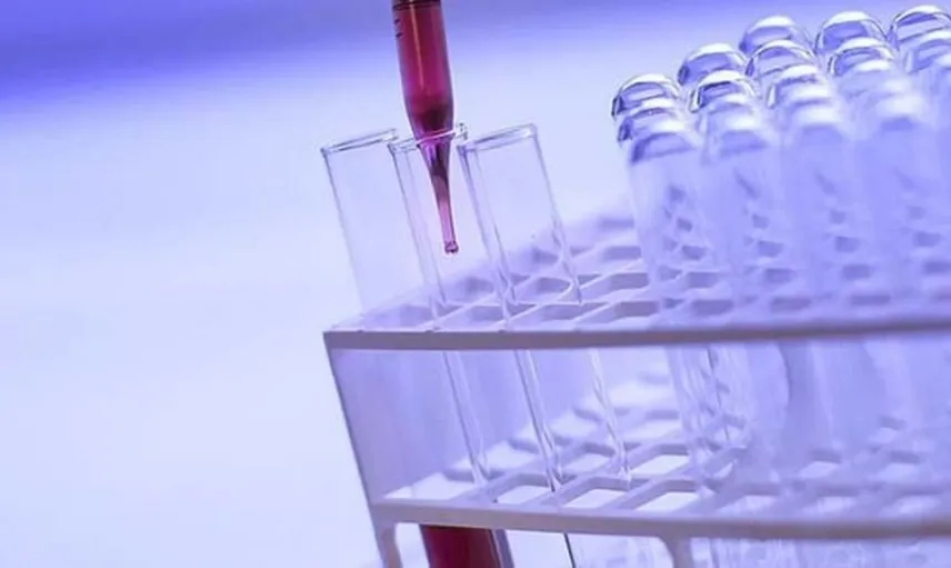 Nadir Hastalıklar Dünyada 300 Milyondan Fazla Kişiyi Etkiliyor