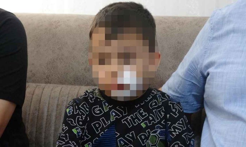 Niğde’de başıboş köpek terörü: 6 yaşındaki anaokulu öğrencisine 11 dikiş atıldı!