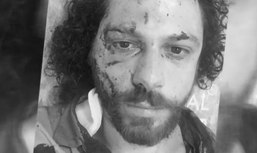 Oyuncu Oral Özer'in Yaralandığı Kadıköy Bar Saldırısı Görüntüleri Ortaya Çıktı