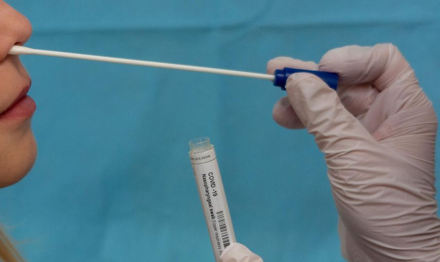 PCR Testi Nedir, Ücretli mi?