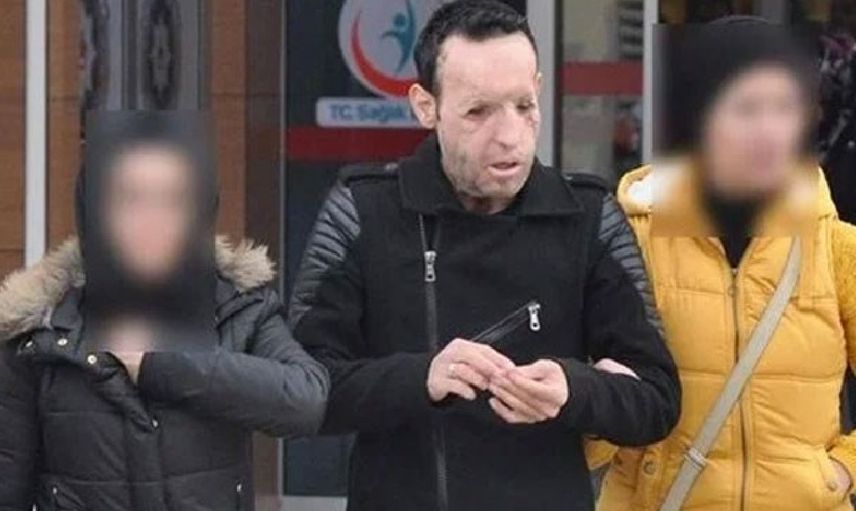 Recep Sert kimdir, tutuklandı mı? Yüz nakli yapılan Recep Sert hakkında bilgiler