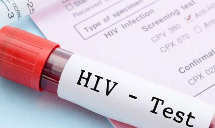 Rusya'da 38 Milyon Kişiye HIV Testi Yapıldı