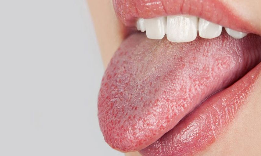 Sjögren sendromu nedir, belirtileri nelerdir? Tedavi edilmediğinde körlüğe yol açan sjögren sendromunun 8 belirtisi
